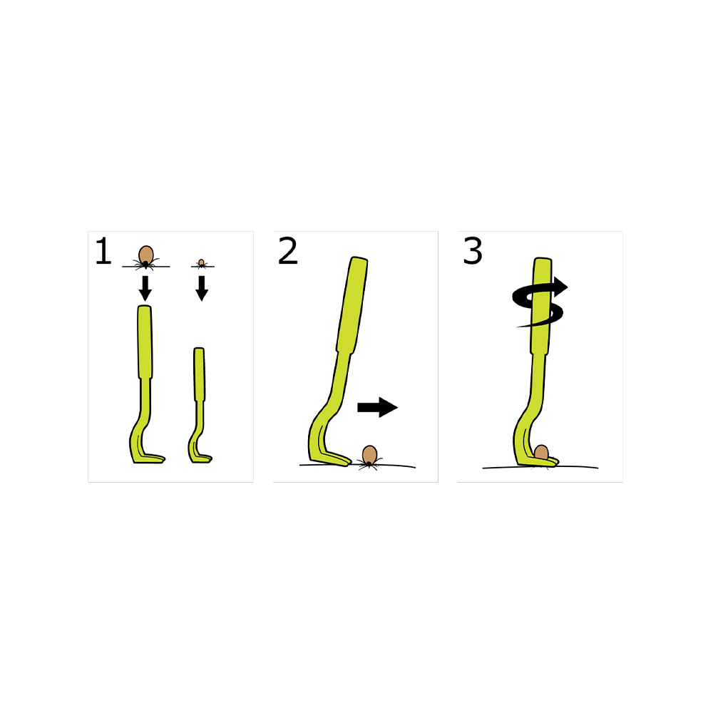 Tick Twister Tick Remover Set - Image 4